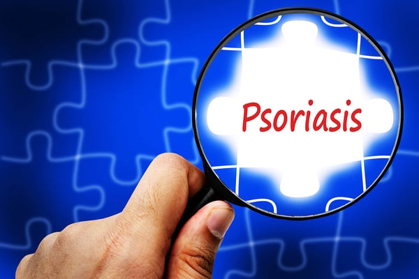 Hand holding a magnifying glass over the word Psoriasis on a glowing blue puzzle background