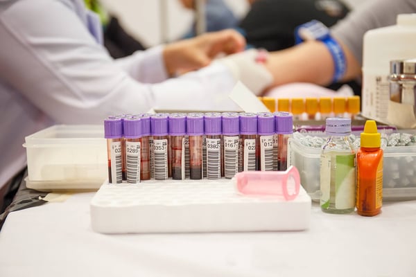 Rack of labeled blood sample tubes on a table, with a blood draw in progress in the background