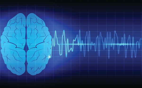 Illustration of a human brain beside a glowing brain-wave line on a blue grid