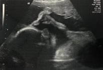 Baby B.jpg