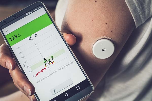 Checking glucose levels