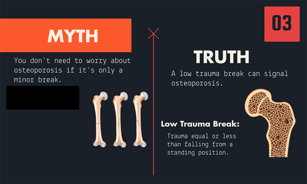 Osteoporosis myth number three
