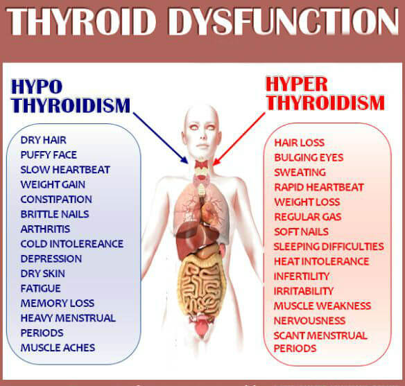 Thyroid dysfuntion comparison