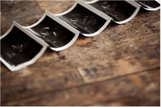 Strip of ultrasound prints curled across a rustic wooden table
