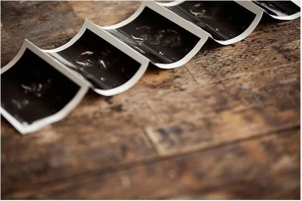 Strip of ultrasound prints curled across a rustic wooden table