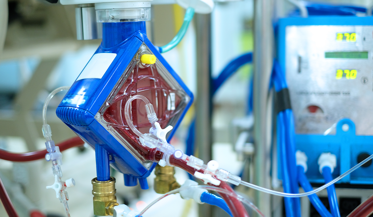 Close view of a medical device with transparent tubing and a fluid-filled chamber connected to control equipment.