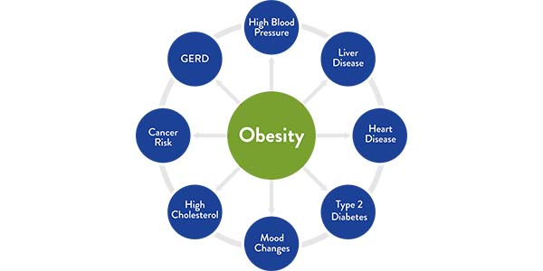 circle in the center with obesity on it surrounded by smaller circles of negative effects