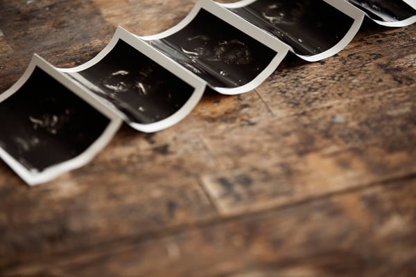 Strip of ultrasound prints curled across a rustic wooden table