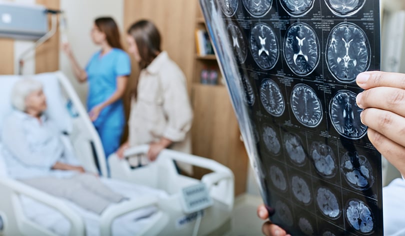 Hand holding brain MRI scans while a nurse and another woman stand beside an older patient in a hospital bed